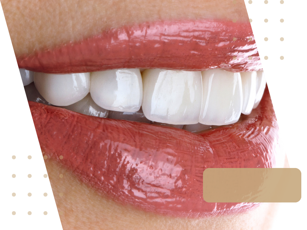 Licówki. Klinika Akademii Stomatologii w Łodzi.