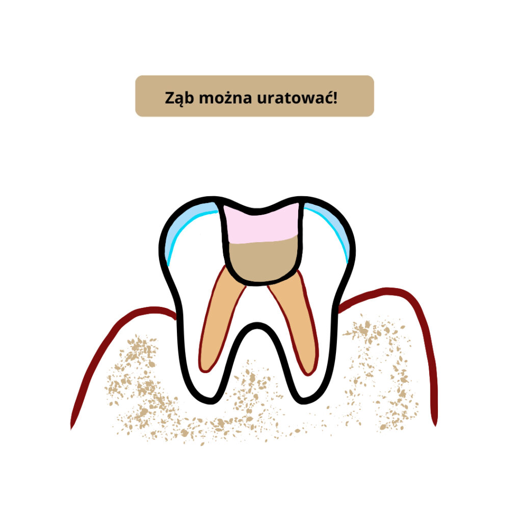 Jak dbać o zęby dziecka. Klinika Akademii Stomatologii w Łodzi.
