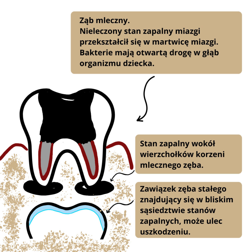Jak dbać o zęby dziecka. Klinika Akademii Stomatologii w Łodzi.