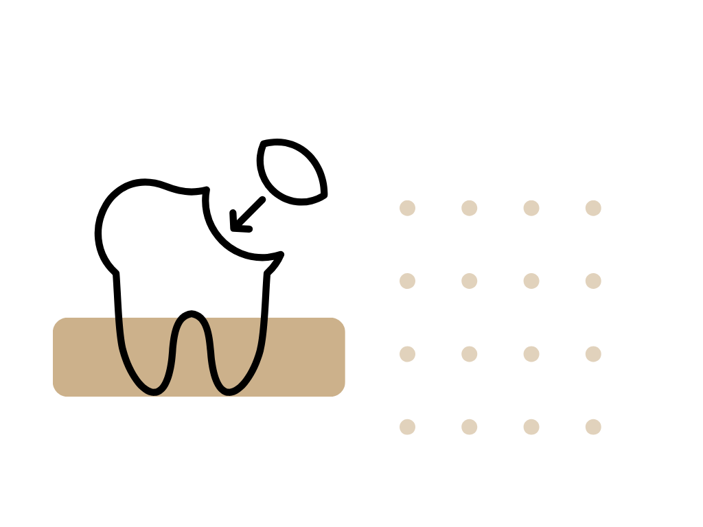 Bonding zębów. Klinika Akademii Stomatologii w Łodzi.