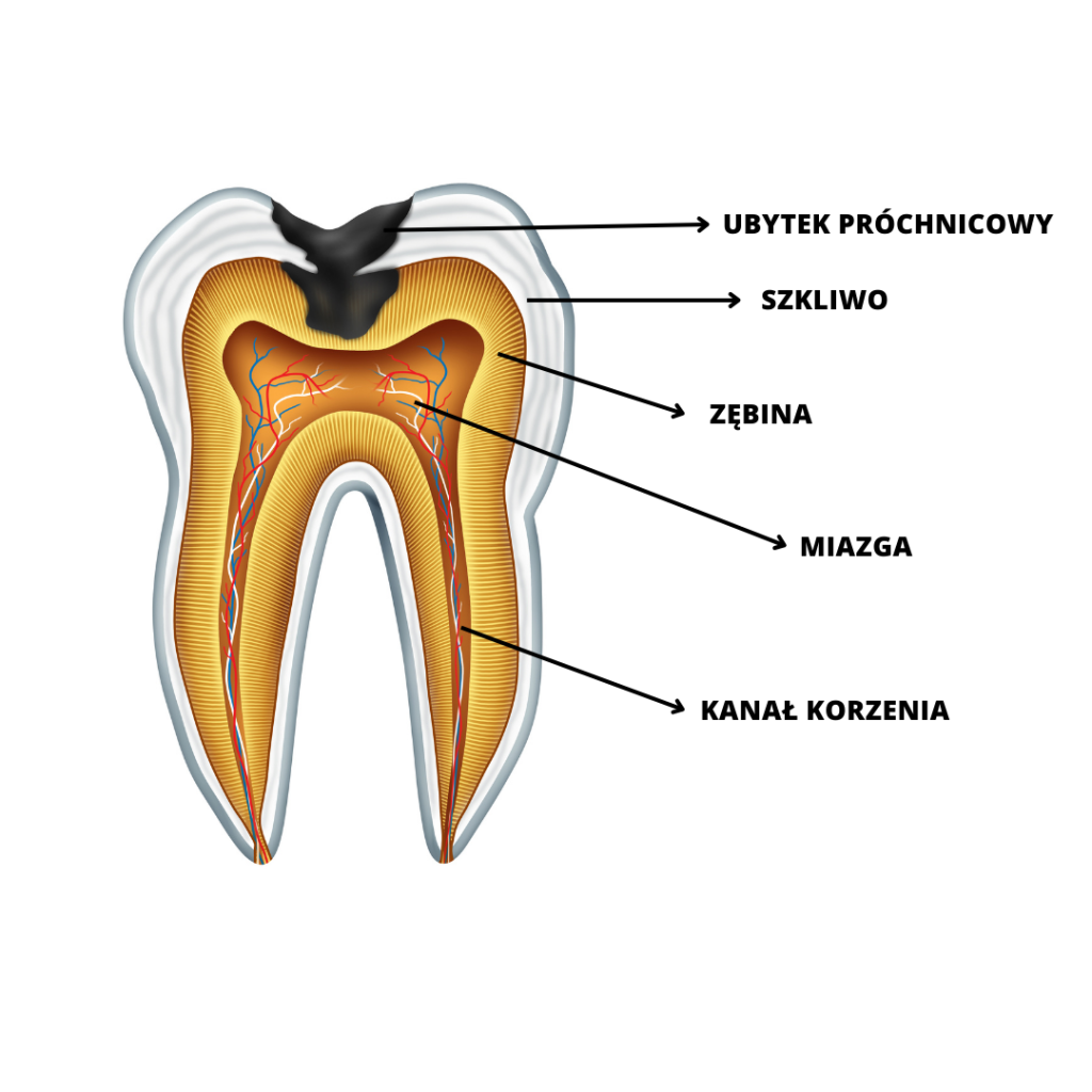 Leczenie kanałowe w Łodzi. Klinika Akademii Stomatologii w Łodzi.